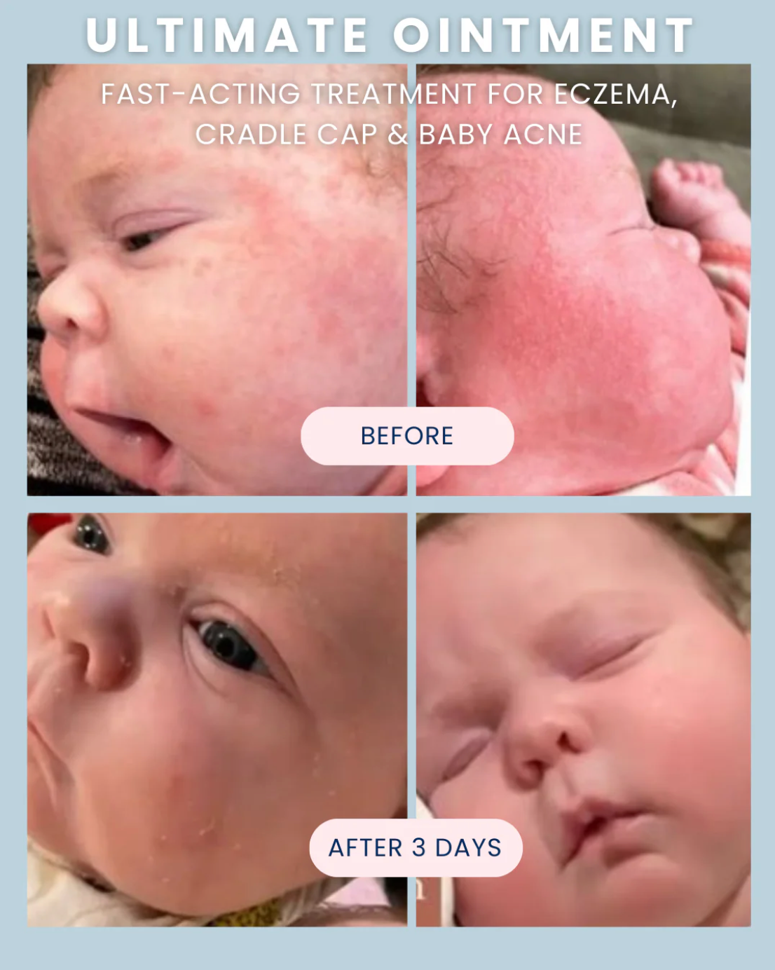 Noodle & Boo Ultimate Baby Ointment
